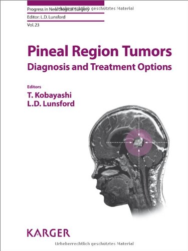 Pineal Region Tumors