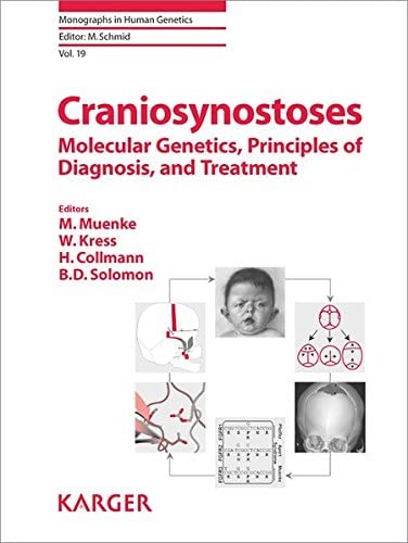 Craniosynostoses