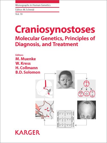 Craniosynostoses