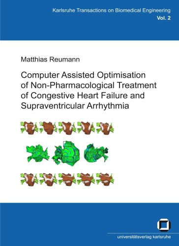 Computer assisted optimisation on non-pharmacological treatment of congestive heart failure and supraventricular arrhythmia