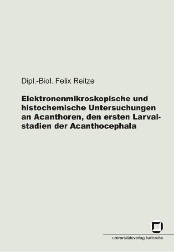 Elektronenmikroskopische Und Histochemische Untersuchungen An Acanthoren, Den Ersten Larvalstadien Der Acanthocephala (German Edition)