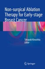 Non-surgical ablation therapy for early-stage breast cancer