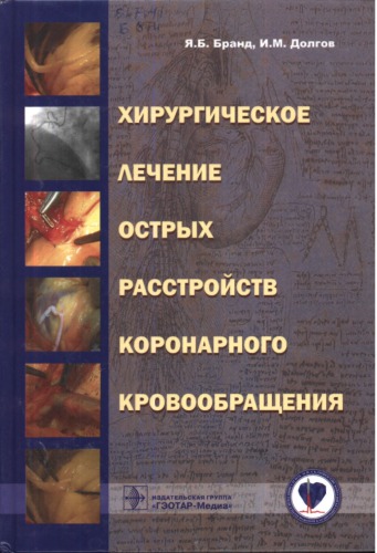 <div class=vernacular lang="ru">Хирургическое лечение острых расстройств коронарного кровообращения /</div>
Khirurgicheskoe lechenie ostrykh rasstroĭstv koronarnogo krovoobrashchenii︠a︡