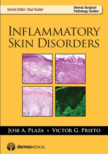 Inflammatory skin disorders