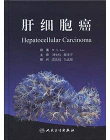 Hepatocellular carcinoma(Chinese Edition)