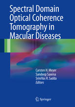 Spectral domain optical coherence tomography in macular diseases