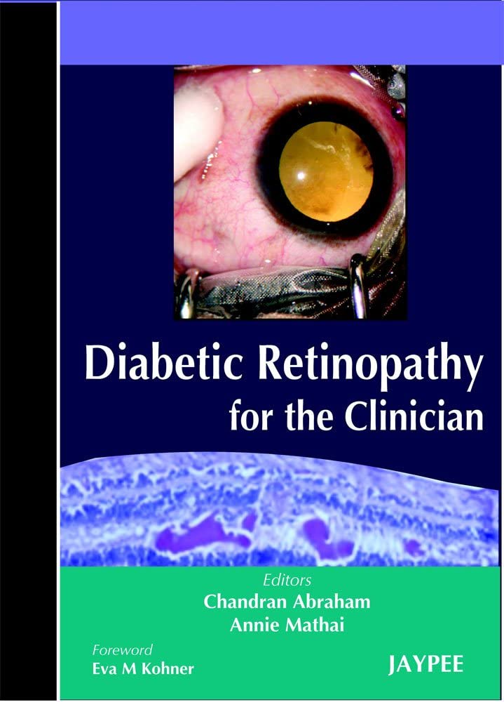 Diabetic Retinopathy for the Clinician