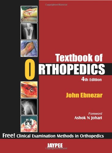 Textbook of Orthopedics [with Clinical Examination Methods in Orthopedics]