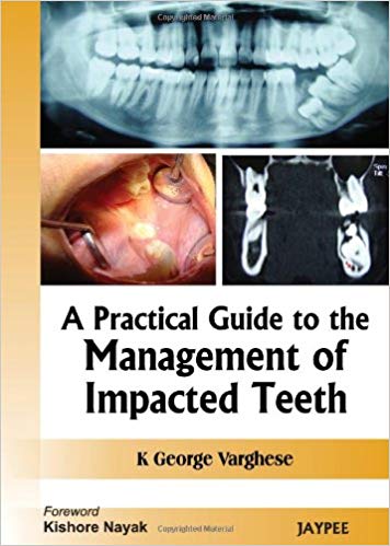 A practical guide to the management of impacted teeth