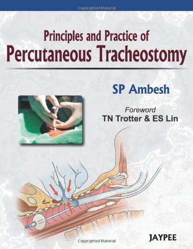 Principles And Practice Of Percutaneous Tracheostomy