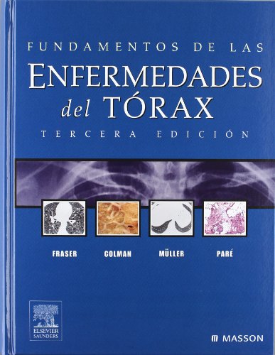 Fundamentos de Las Enfermedades del Torax