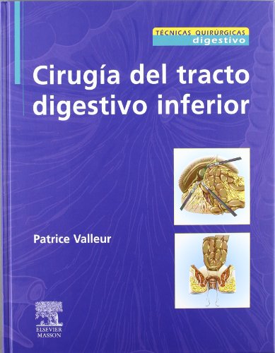 Cirugía del tracto digestivo inferior