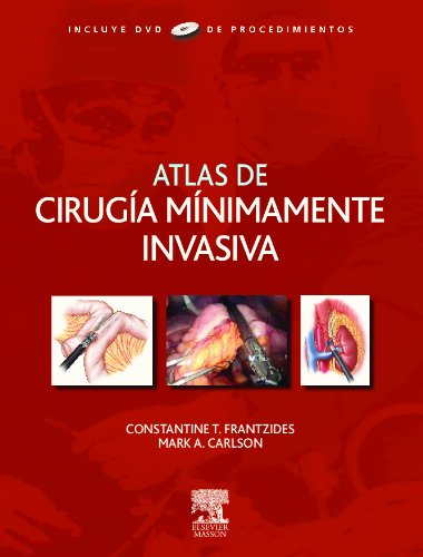 Atlas de cirugía minimamente invasiva