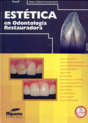 Estética en odontología restauradora