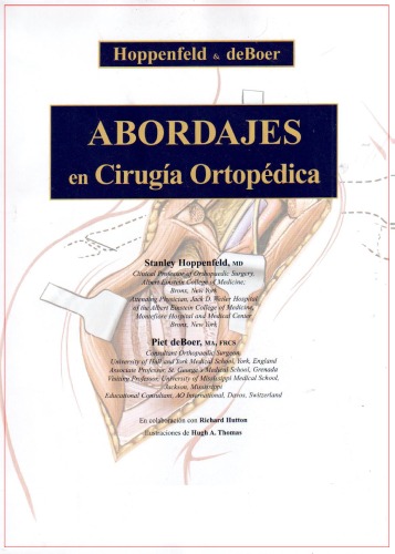 Abordajes en cirugía ortopédica