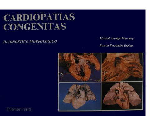 Cardiopatías congénitas : diagnóstico morfológico