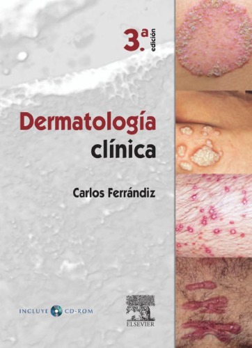 Dermatología clínica