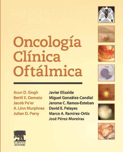 Oncología clínica oftálmica