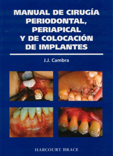 Manual de Cirugia Periodontal, Periapical Y de Colocacion de Implantes