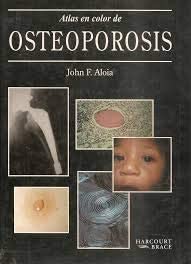 Atlas en Color de Osteoporosis (Spanish Edition)