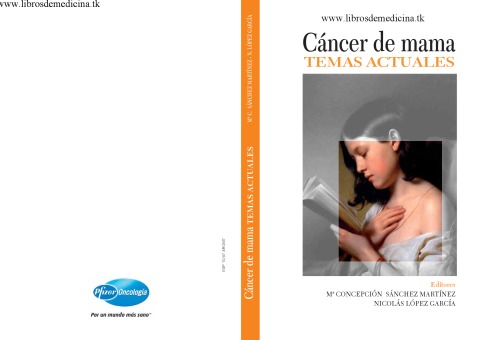 Cáncer de mama : Temas actuales