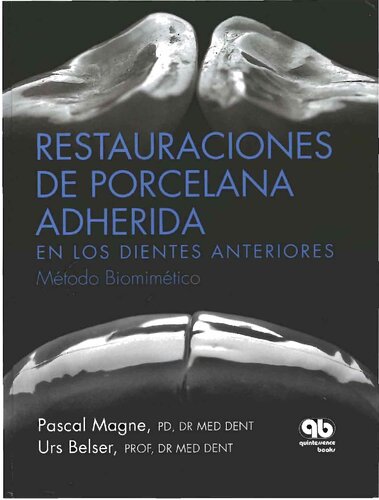 Restauraciones de porcelana adherida en los dientes anteriores : método biomimético