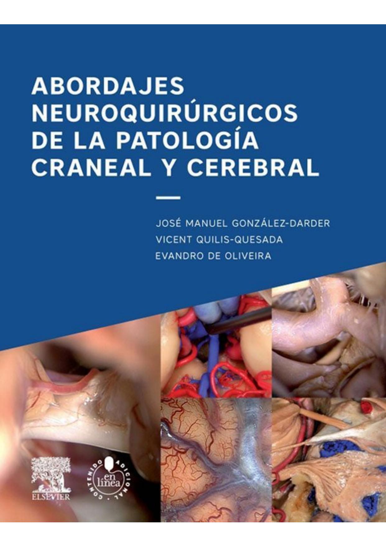 Abordajes Neuroquir�rgicos de la Patolog�a Craneal Y Cerebral