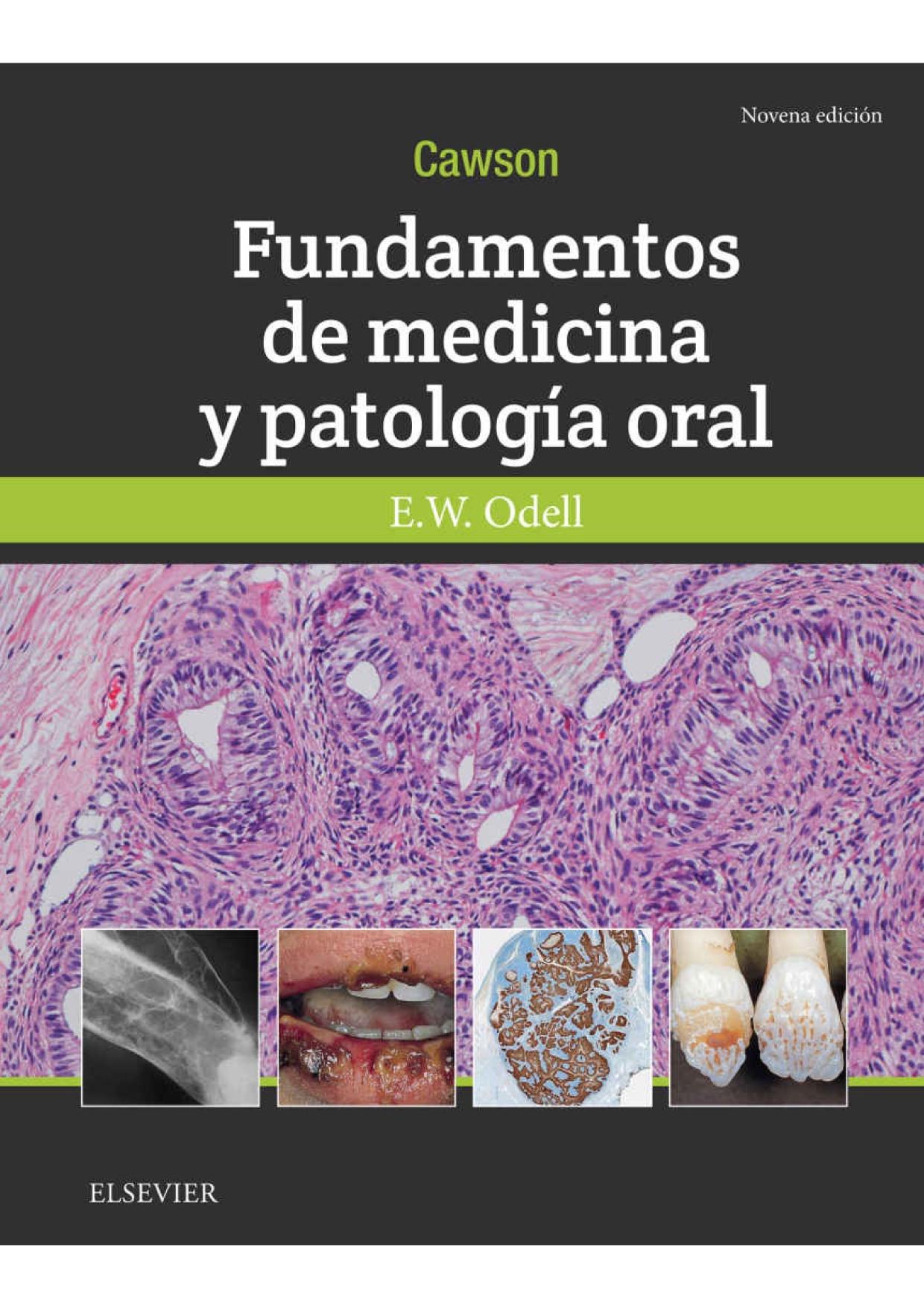 Cawson.Fundamentos de Medicina Y Patolog�a Oral