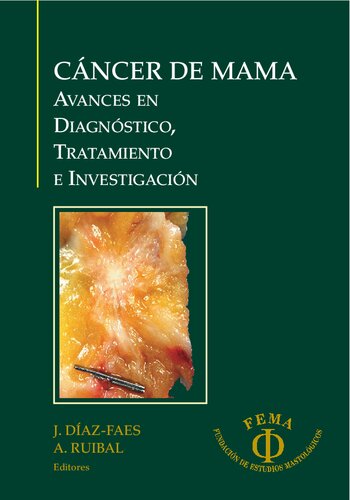 Cáncer de mama : avances en diagnóstico, tratamiento e investigación