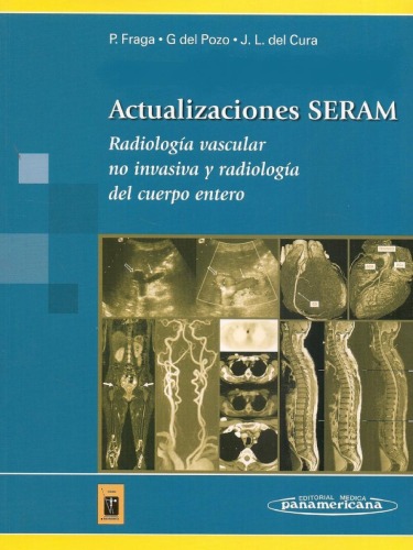 Radiología vascular no invasiva y radiología del cuerpo entero