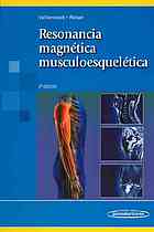 Resonancia magnética musculoesquelética 59 cuadros