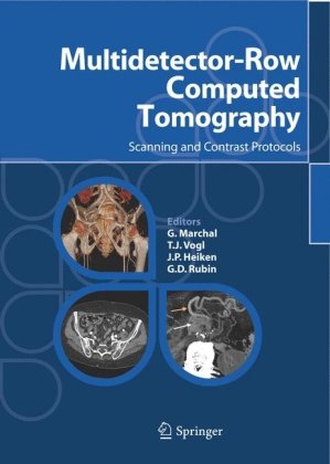 Multidetectorrow Computed Tomography