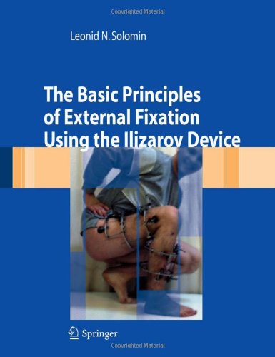 The Basic Principles of External Fixation Using the Ilizarov Device