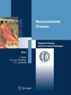 Musculoskeletal Diseases