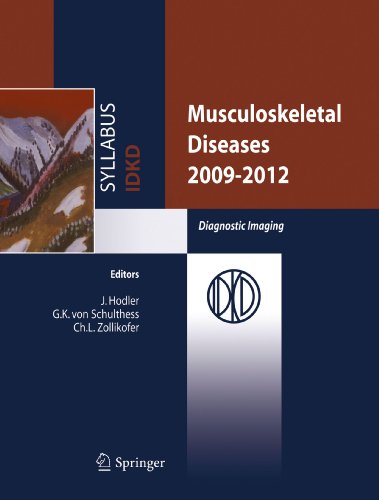 Musculoskeletal Diseases