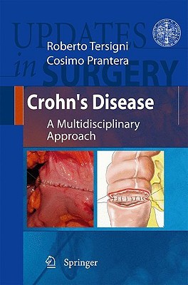 Crohn's Disease