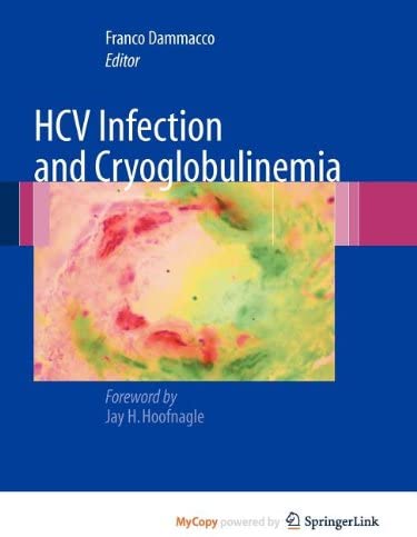 HCV Infection and Cryoglobulinemia