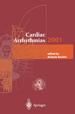 Cardiac Arrhythmias 2001 : Proceedings of the 7th International Workshop on Cardiac Arrhythmias (Venice, 7-10 October 2001).