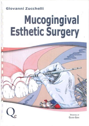 Mucogingival Esthetic Surgery