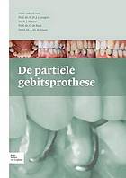 de Partiele Gebitsprothese