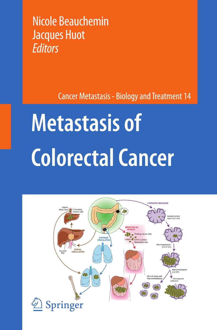 Metastasis of Colorectal Cancer