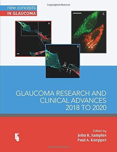 Glaucoma Research and Clinical Advances