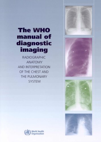 The WHO Manual of Diagnostic Imaging