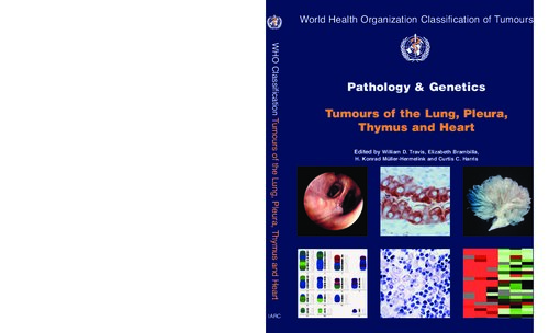 Pathology and Genetics of Tumours of the Lung, Pleura, Thymus and Heart (IARC WHO Classification of Tumours)