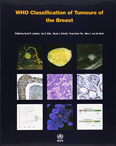 Who Classification of Tumours of the Breast [op]