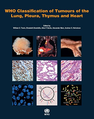 Who Classification of Tumours of the Lung, Pleura, Thymus and Heart