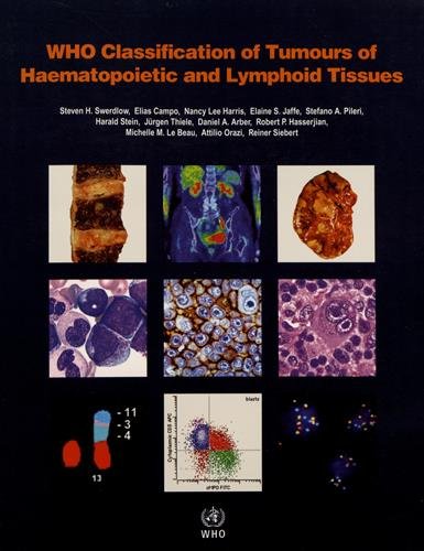 Who Classification of Tumours of Haematopoietic and Lymphoid Tissues