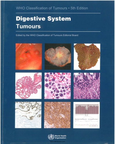 Digestive System Tumours