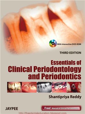 Essentials of Clinical Periodontology and Periodontics