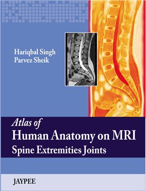 Atlas of Human Anatomy on MRI